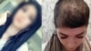 28-летняя Шахзода Хусанова до и после «самосуда».
