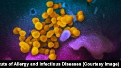 Noul coronavirus (în galben), văzut la microscop electronic